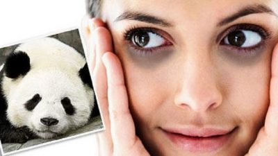 Cara Menghilangkan Mata Panda dengan Mudah dan Hanya di Rumah