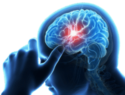 Layanan Pemeriksaan Dokter Spesialis Saraf RSUD Pandega Pangandaran